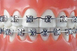 怎样牙齿修复联系方式