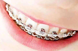 专业牙齿修复哪些方法