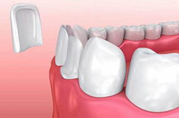 怎么牙齿修复有危害吗