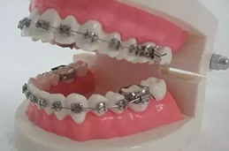 如何牙齿修复选哪家
