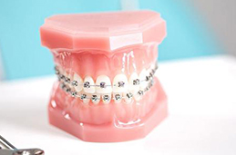 如何牙齿修复方法